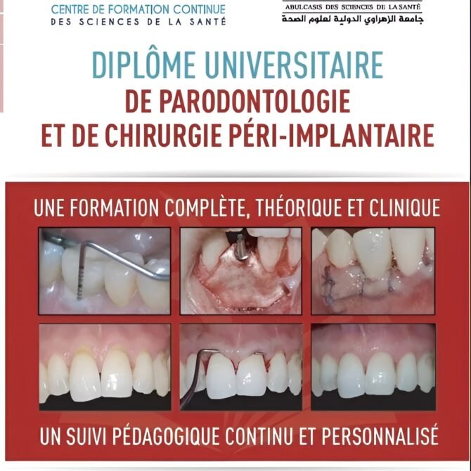 DU En Parodontologie et de Chirurgie Péri-implantite