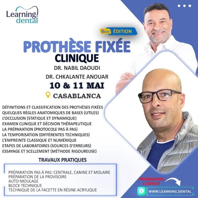 Prothèse Fixée Clinique