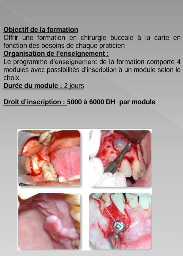FMDR Formation Courte Durée En Odontologie Chirurgicale