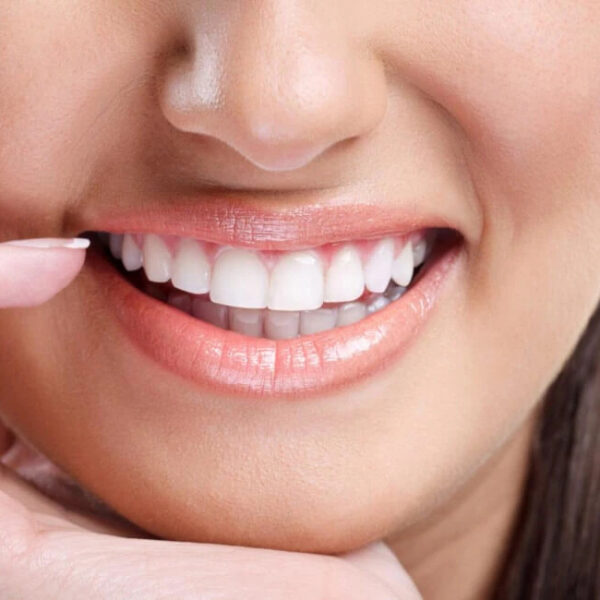All Dental : Certificat Universitaire en Esthétique dentaire
