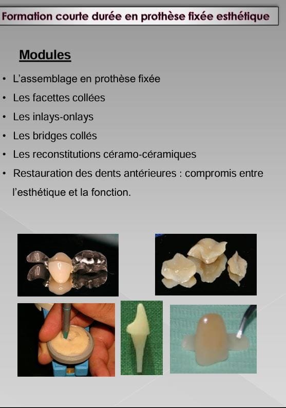FMDR Formation Courte Durée En Prothèse Fixée Esthétique