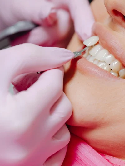 Dentisterie Esthétique