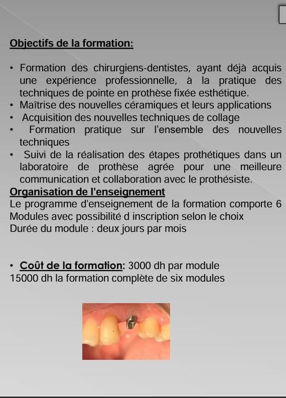 FMDR Formation Courte Durée En Prothèse Fixée Esthétique