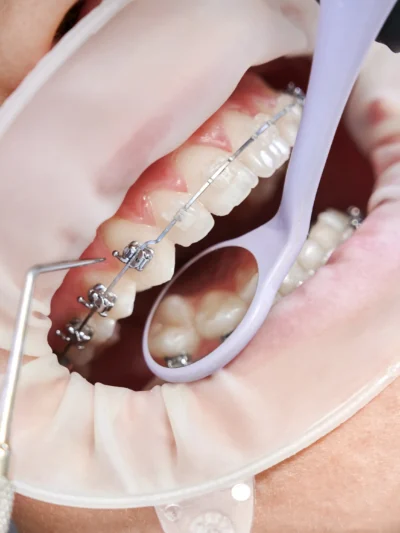 Orthodontie