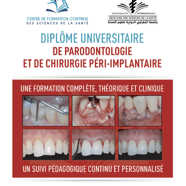 (UIASS) D.U. En Parodontologie et de Chirurgie Péri-implantite