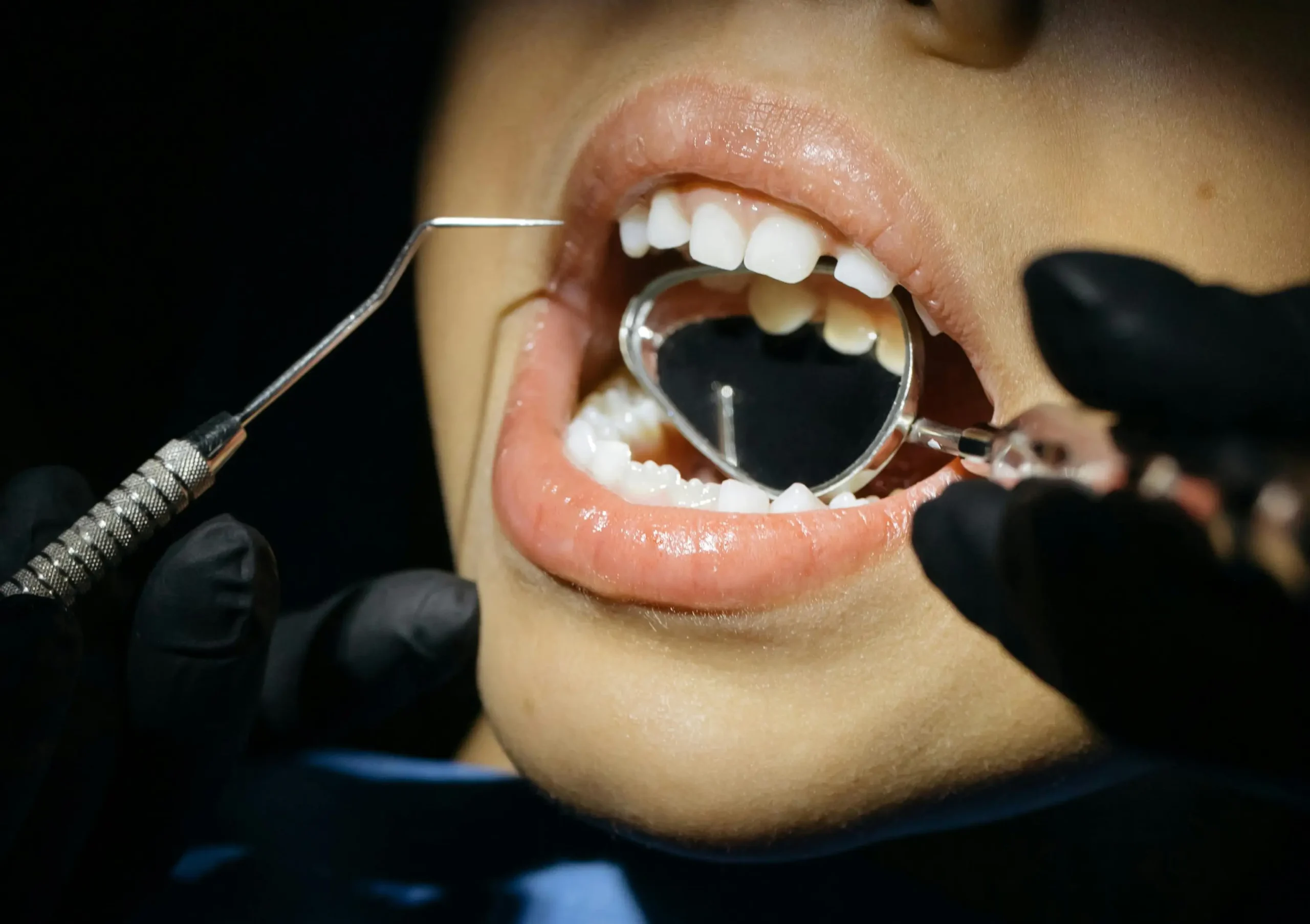 Examen dentaire avec miroir et sonde. Soins dentaires.