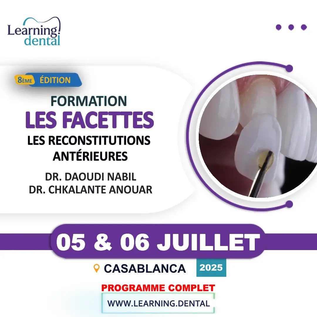 Formation Les Facettes