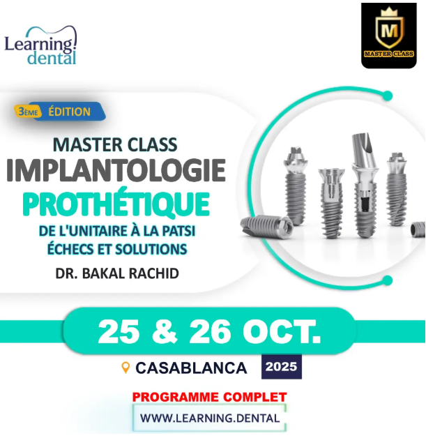 Echecs et solutions prothétiques en implantologie