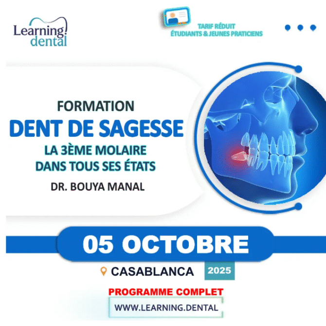 Formation Dent De Sagesse