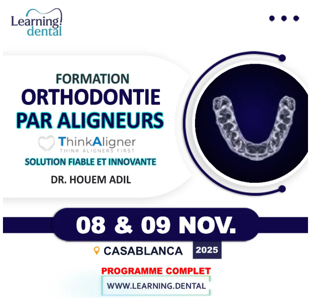 Formation d’orthodontie par aligneurs : Thinkaligner