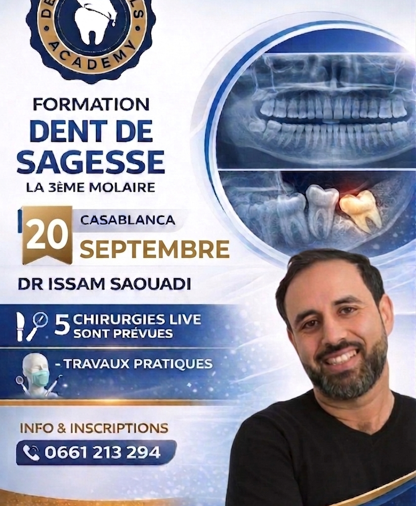LA DENT DE SAGESSE