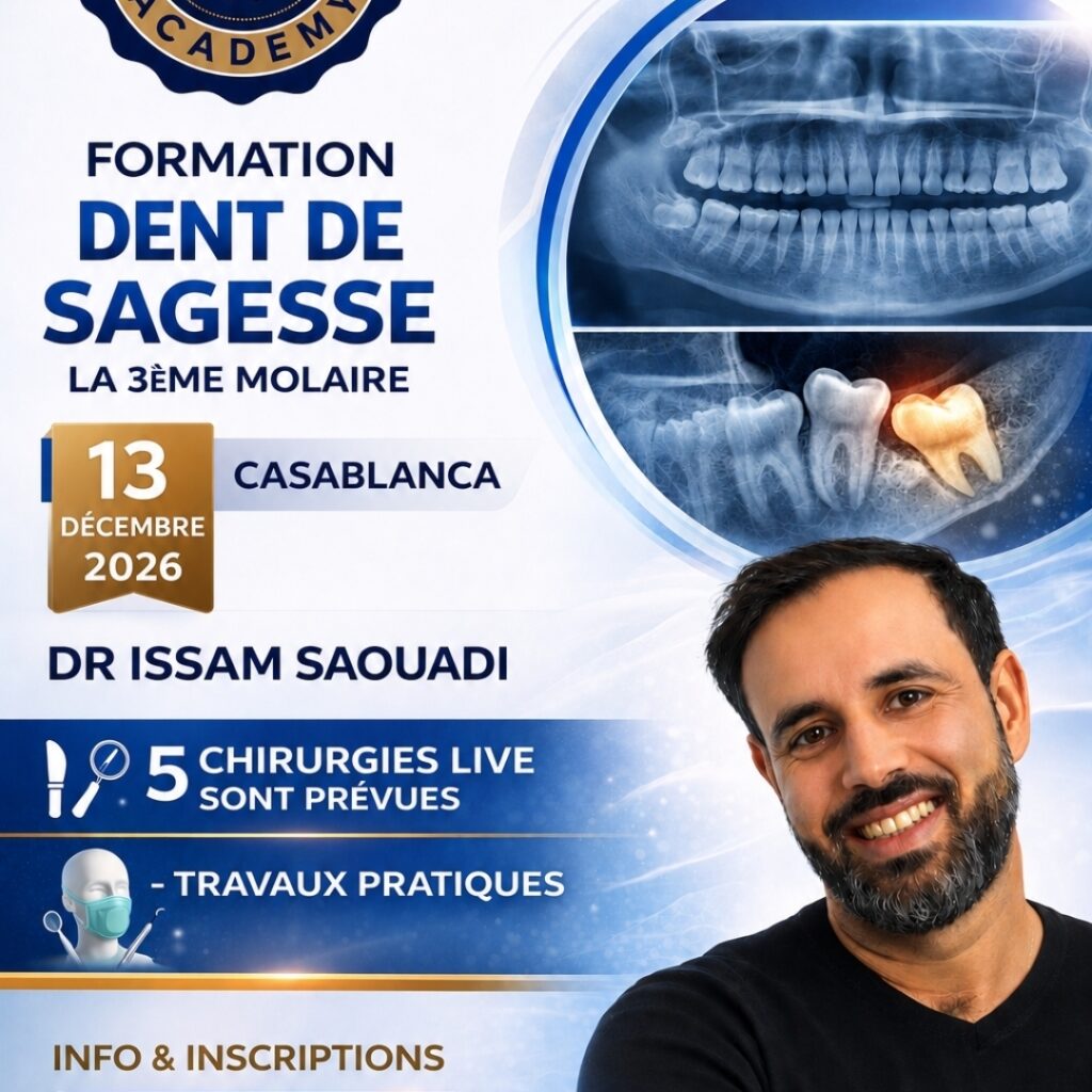 LA DENT DE SAGESSE