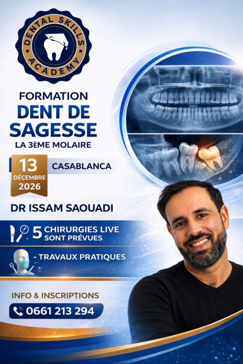 LA DENT DE SAGESSE