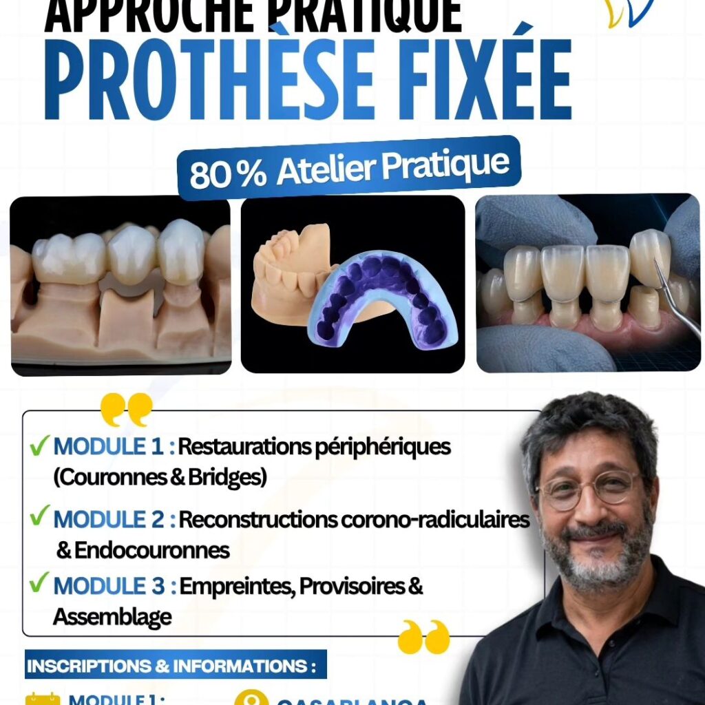 Masterclass Facette en céramique