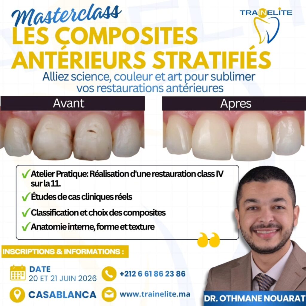 Masterclass les composites antérieures stratifiés