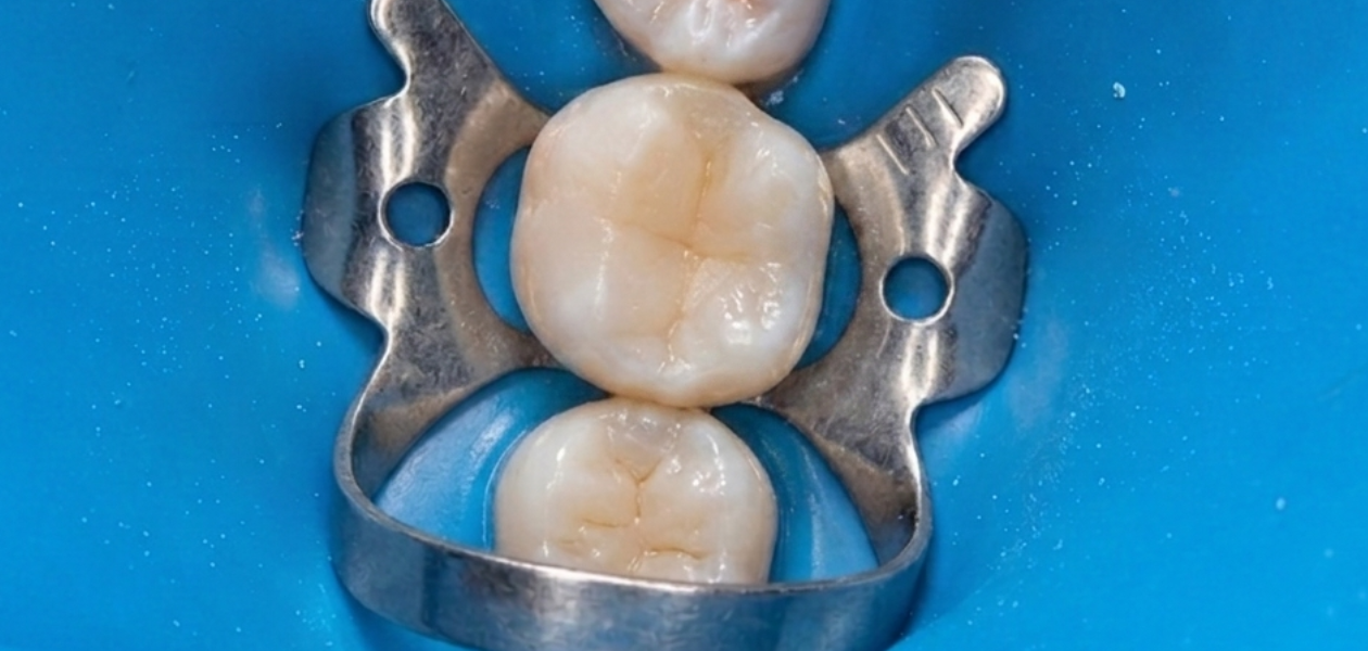 Dents isolées avec une digue dentaire, utilisées pour les formations dentaires au Maroc.