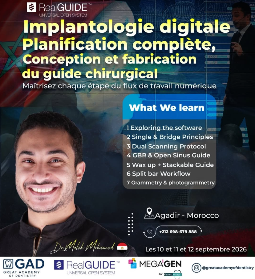 Implantologie Digitale – Planification complète, Conception et Fabrication du Guide Chirurgical