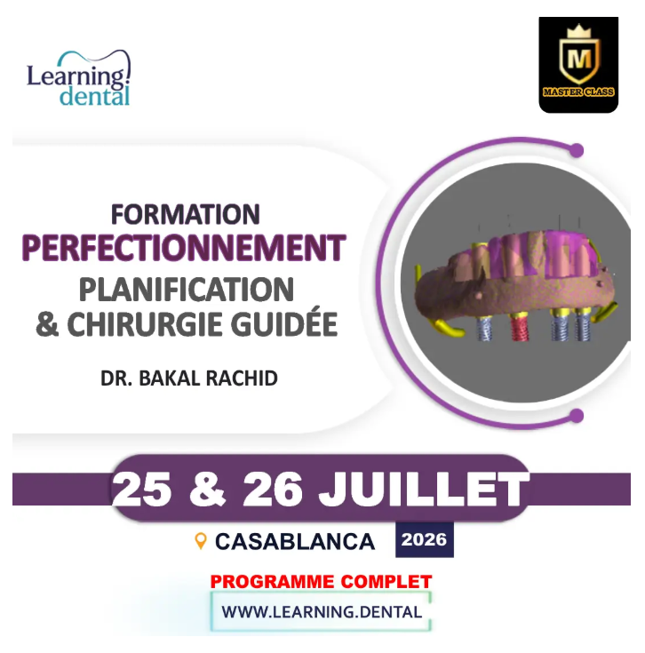 Perfectionnement en planification implantaire numérique et chirurgie guidée