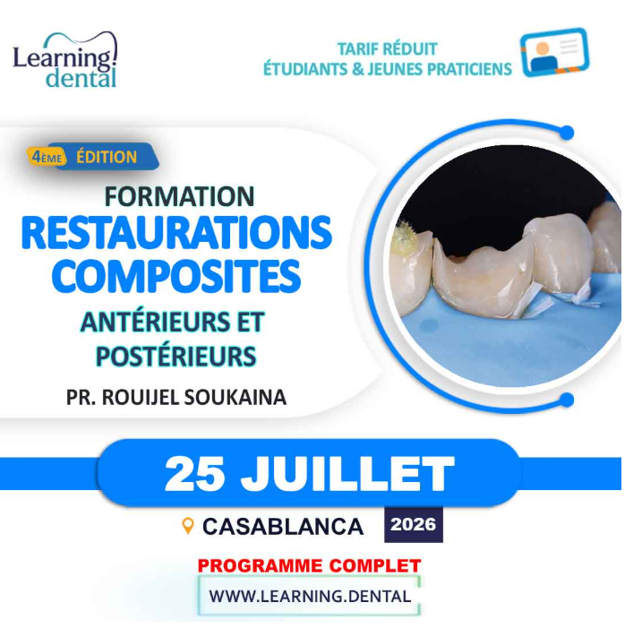 Workshop stratification aux composites