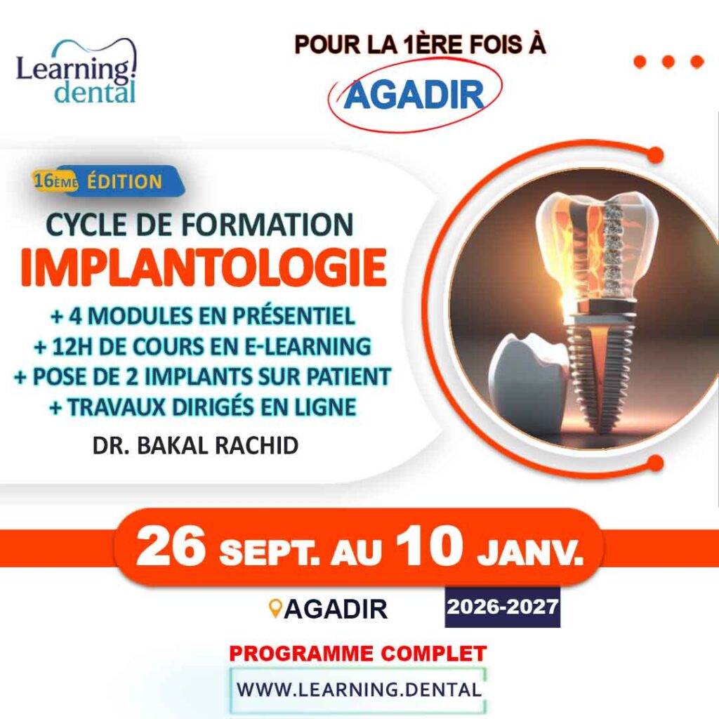 Cycle de formation en implantologie à Agadir