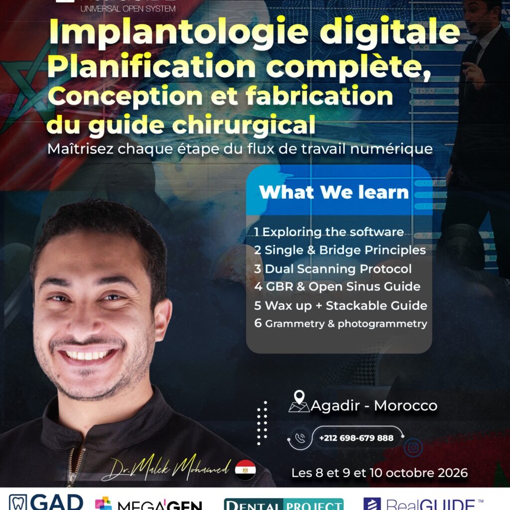 Implantologie digitale