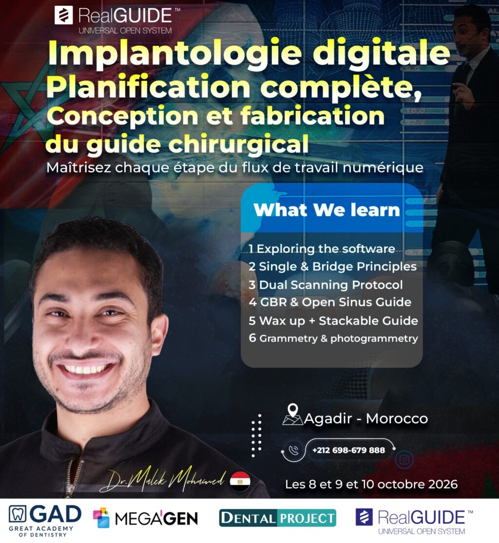 Implantologie digitale